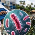 Shigella Bacteria Scare