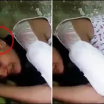 Ear Surgery Error Costs 20-Year-Old Her Arm And Wedding